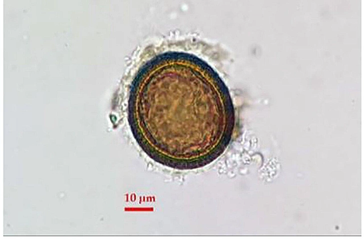 Поскребли в ночных горшках: ученые узнали, от каких паразитов страдали жители римского форпоста на Дунае